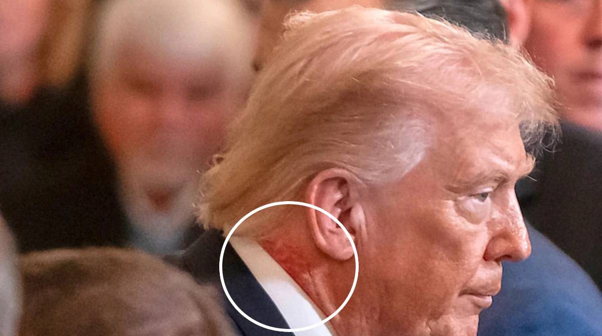 Donald Trump neck
